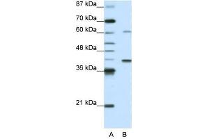 MGC46336 antibody used at 0. (ZNF843 Antikörper  (N-Term))