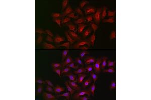Immunofluorescence analysis of U2OS cells using B Rabbit pAb (ABIN6129899, ABIN6136816, ABIN6136817 and ABIN6222589) at dilution of 1:100 (40x lens). (ALOX15B Antikörper  (AA 1-200))