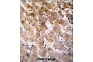 MBTD1 Antibody (C-term) (ABIN655319 and ABIN2844896) immunohistochemistry analysis in formalin fixed and paraffin embedded human liver tissue followed by peroxidase conjugation of the secondary antibody and DAB staining. (MBTD1 Antikörper  (C-Term))