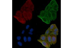 ABIN6262776 and ABIN6266570 staining Hela cells(24h of starvation treatment) by IF/ICC. (KRT17 Antikörper  (C-Term))