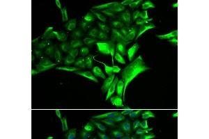 Immunofluorescence analysis of MCF-7 cells using PYGB Polyclonal Antibody (PYGB Antikörper)