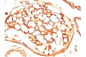 Mouse visceral fat tissue was stained by Rabbit Anti-sFRP-2 (25-50) (Human) Antiserum (SFRP2 Antikörper  (AA 25-50))