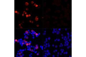 Immunofluorescence analysis of 293T cells transfected with SARS-CoV-2 Spike protein and untreated 293T cells use SARS-CoV-2 Spike Rabbit pAb (ABIN7266506) at dilution of 1:100 (40x lens). (Coronavirus Spike Glycoprotein Antikörper)