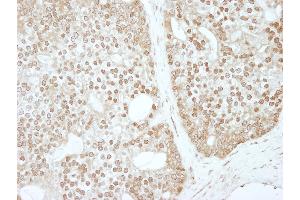 anti-Zinc Finger and BTB Domain Containing 40 (ZBTB40) (AA 1140-1190) antibody