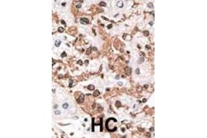 Immunohistochemistry (IHC) image for anti-Kv Channel Interacting Protein 3, Calsenilin (KCNIP3) antibody (ABIN2998445)