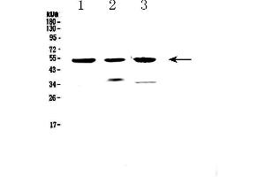 Western blot analysis of HTRA1 using anti-HTRA1 antibody .