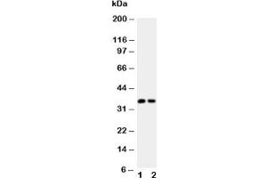 Western blot testing of Calbindin antibody (0. (CALB1 Antikörper  (AA 2-175))