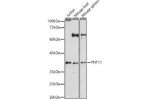 Western blot analysis of extracts of various cell lines, using PHF11 antibody (ABIN6128438, ABIN6145534, ABIN6145536 and ABIN6223765) at 1:1000 dilution. (PHF11 Antikörper  (AA 1-292))