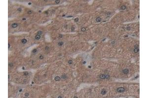Detection of AATK in Human Liver Tissue using Polyclonal Antibody to Apoptosis Associated Tyrosine Kinase (AATK)