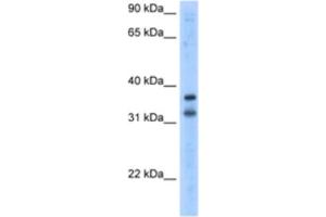 Western Blotting (WB) image for anti-Potassium Channel Regulator (KCNRG) antibody (ABIN2461173)