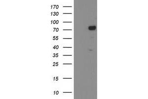 Western Blotting (WB) image for anti-Katanin P80 (WD Repeat Containing) Subunit B 1 (KATNB1) antibody (ABIN1498987) (KATNB1 Antikörper)