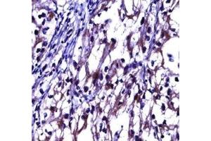 Immunohistochemistry (IHC) image for anti-Tumor Necrosis Factor Receptor Superfamily, Member 11b (TNFRSF11B) (AA 243-271) antibody (ABIN3029353)