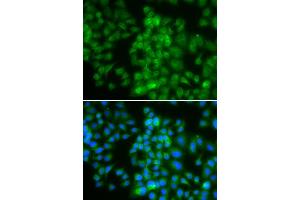 Immunofluorescence analysis of HeLa cell using LMO4 antibody. (LMO4 Antikörper)