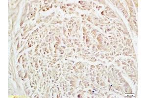 Immunohistochemistry (Paraffin-embedded Sections) (IHC (p)) image for anti-Adaptor-Related Protein Complex 2, alpha 2 Subunit (AP2A2) (AA 21-150) antibody (ABIN673674)