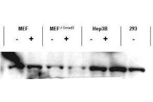 Western blot using  affinity purified anti-Smad3 antibody shows detection of endogenous Smad3 in both unstimulated and stimulated cell lysates. (SMAD3 Antikörper  (C-Term))