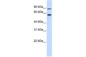EFEMP1 antibody used at 1 ug/ml to detect target protein. (FBLN3 Antikörper  (Middle Region))