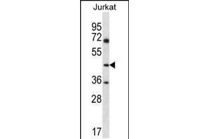 Western blot analysis in Jurkat cell line lysates (35ug/lane). (ASS1 Antikörper  (C-Term))