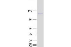 Western Blotting (WB) image for Disrupted in Schizophrenia 1 (DISC1) (Transcript Variant L) protein (Myc-DYKDDDDK Tag) (ABIN2719502)