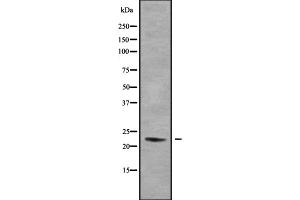 Western blot analysis of DUX5 using HeLa whole cell lysates (DUX5 Antikörper  (N-Term))