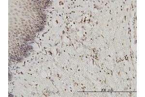 Immunoperoxidase of monoclonal antibody to HYI on formalin-fixed paraffin-embedded human esophagus. (HYI Antikörper  (AA 1-217))