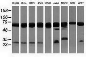 Image no. 3 for anti-Pseudouridylate Synthase 7 Homolog (PUS7) antibody (ABIN1500514) (PUS7 Antikörper)