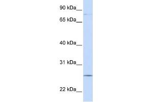 PCDHGC3 antibody used at 1 ug/ml to detect target protein. (Protocadherin gamma Subfamily C, 3 (PCDHGC3) (N-Term) Antikörper)