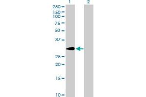 Western Blot analysis of SLA expression in transfected 293T cell line by SLA MaxPab polyclonal antibody.