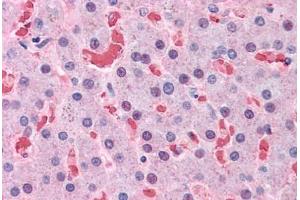 Human Liver: Formalin-Fixed, Paraffin-Embedded (FFPE) (Hemoglobin Subunit beta Antikörper  (AA 38-148))