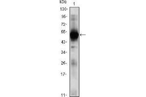 Western blot analysis using RAG2 mouse mAb against RAG2(AA: 350-527)-hIgGFc transfected HEK293 (1)cell lysate.