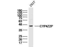 293T lysates probed with CYP4Z2P Polyclonal Antibody, Unconjugated  at 1:300 dilution and 4˚C overnight incubation. (CYP4Z2P Antikörper  (AA 51-150))