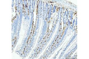 IHC analysis of FABP4 using anti-FABP4 antibody (ABIN7603145).