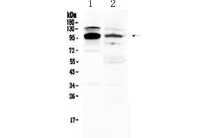 Western blot analysis of NFAT2 using anti-NFAT2 antibody . (NFATC1 Antikörper  (AA 589-652))