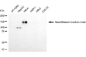 Western blotting analysis using neurofilament medium chain antibody (ABIN7799580).