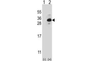 Western Blotting (WB) image for anti-Clathrin, Light Chain B (CLTB) antibody (ABIN2997028) (CLTB Antikörper)