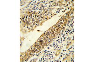 Immunohistochemistry (IHC) image for anti-Cytochrome P450, Family 51, Subfamily A, Polypeptide 1 (CYP51A1) antibody (ABIN3003944) (CYP51A1 Antikörper)