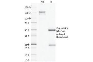 SDS-PAGE Analysis of Purified, BSA-Free Factor XIIIa Antibody (clone F13A1/1683). (F13A1 Antikörper  (AA 46-181))