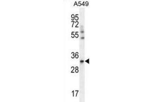 Western Blotting (WB) image for anti-Solute Carrier Family 25 (Mitochondrial Carrier, Adenine Nucleotide Translocator), Member 6 (SLC25A6) antibody (ABIN2996577) (SLC25A6 Antikörper)
