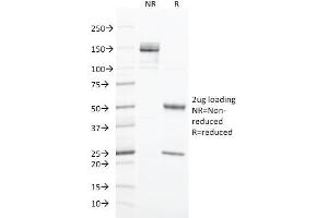 SDS-PAGE Analysis Purified Cytokeratin 20 Mouse Monoclonal Antibody (SPM191). (KRT20 Antikörper  (AA 196-323))