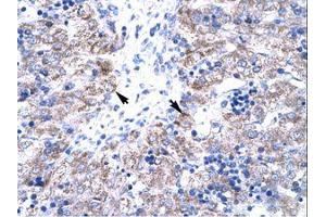 Image no. 1 for anti-HIV-1 Tat Interactive Protein 2, 30kDa (HTATIP2) (AA 30-79) antibody (ABIN202114) (HIV-1 Tat Interactive Protein 2, 30kDa (HTATIP2) (AA 30-79) Antikörper)