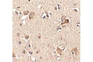 Immunohistochemistry of Aipl1 in human brain tissue with Aipl1 antibody at 2.