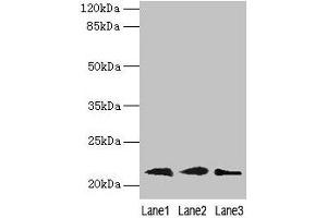 Western blot All lanes: RAP1B antibody at 0. (RAP1B Antikörper  (AA 1-181))