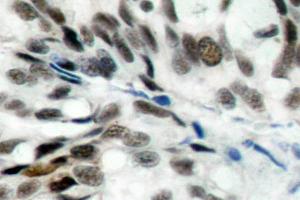 Image no. 1 for anti-Retinoblastoma 1 (RB1) antibody (ABIN271801) (Retinoblastoma 1 Antikörper)