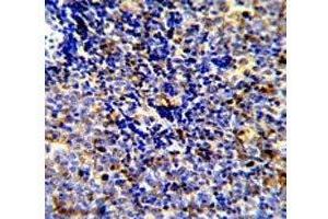 Immunohistochemistry (IHC) image for anti-C-Mer Proto-Oncogene Tyrosine Kinase (MERTK) antibody (ABIN3030229)