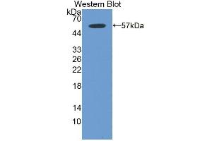 Detection of Recombinant ITGb6, Mouse using Polyclonal Antibody to Integrin Beta 6 (ITGb6)