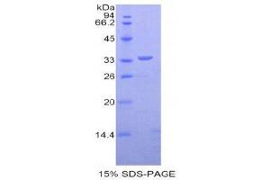 SDS-PAGE (SDS) image for Dystrophin (DMD) (AA 3048-3328) protein (His tag) (ABIN1877297)