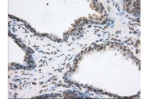 Image no. 3 for anti-Transforming, Acidic Coiled-Coil Containing Protein 3 (TACC3) antibody (ABIN1498097) (TACC3 Antikörper)