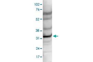 Nuclear extracts of HeLa cells (40 ug) were analysed by Western blot using CCDC101 polyclonal antibody  diluted 1 : 1,000 in TBS-Tween containing 5% skimmed milk. (SGF29 Antikörper)