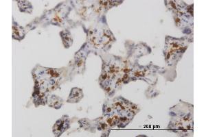 Immunoperoxidase of monoclonal antibody to MRC1 on formalin-fixed paraffin-embedded human placenta. (Macrophage Mannose Receptor 1 Antikörper  (AA 22-130))