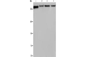 Western Blotting (WB) image for anti-Filamin A, alpha (FLNA) antibody (ABIN2423478) (Filamin A Antikörper)