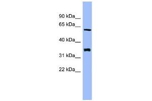 WB Suggested Anti-HECA Antibody Titration: 0. (HECA Antikörper  (Middle Region))